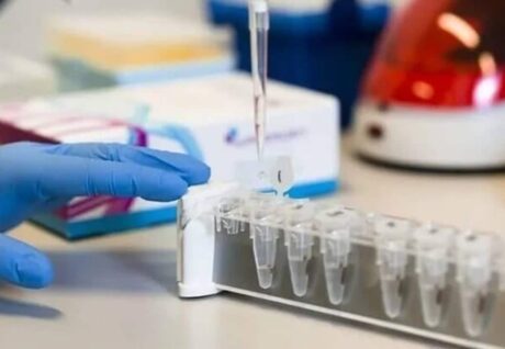 Türkiye’de SMA Tarama Programından 1 Milyon 834 Kişi Faydalandı