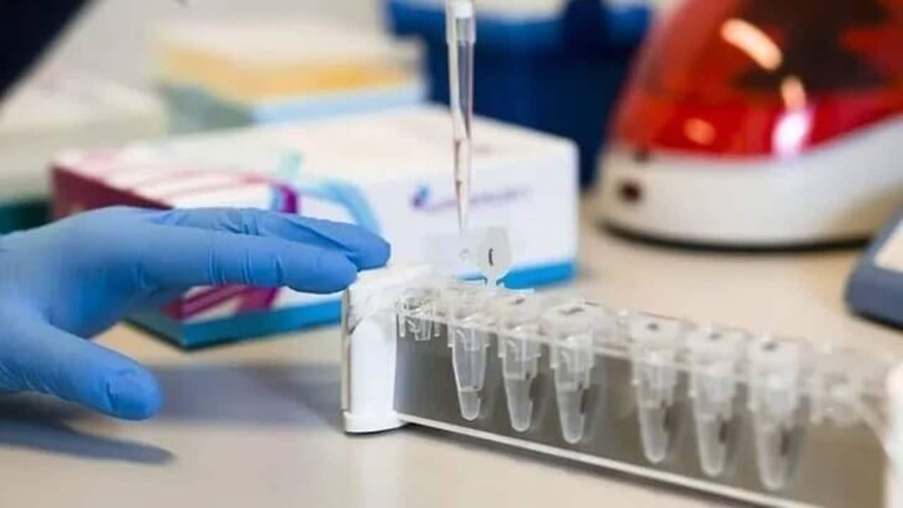 Türkiye’de SMA Tarama Programından 1 Milyon 834 Kişi Faydalandı