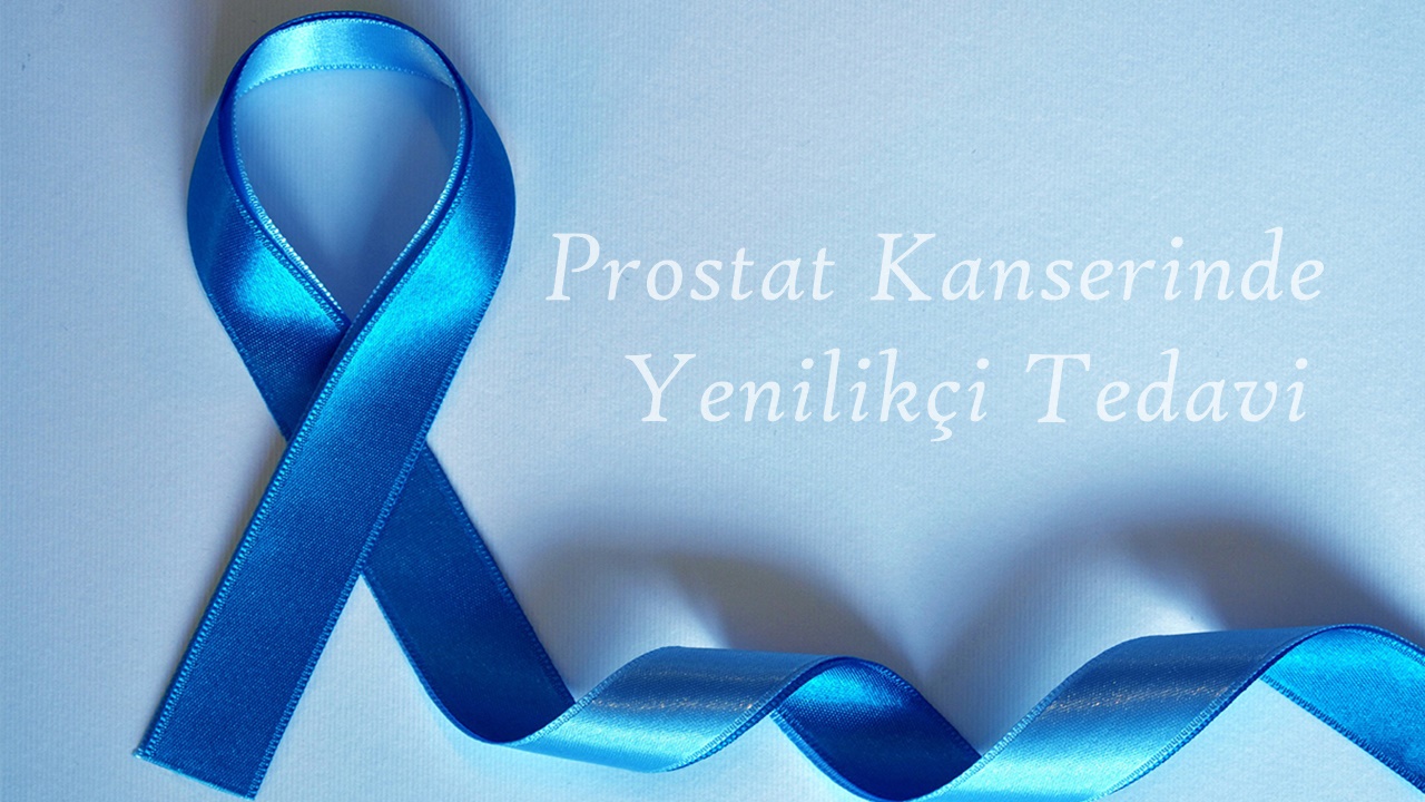 Prostat Kanseri Tedavisinde Çığır Açan Yöntem: Radyoterapi Dozu Yüzde 75 Azaltıldı