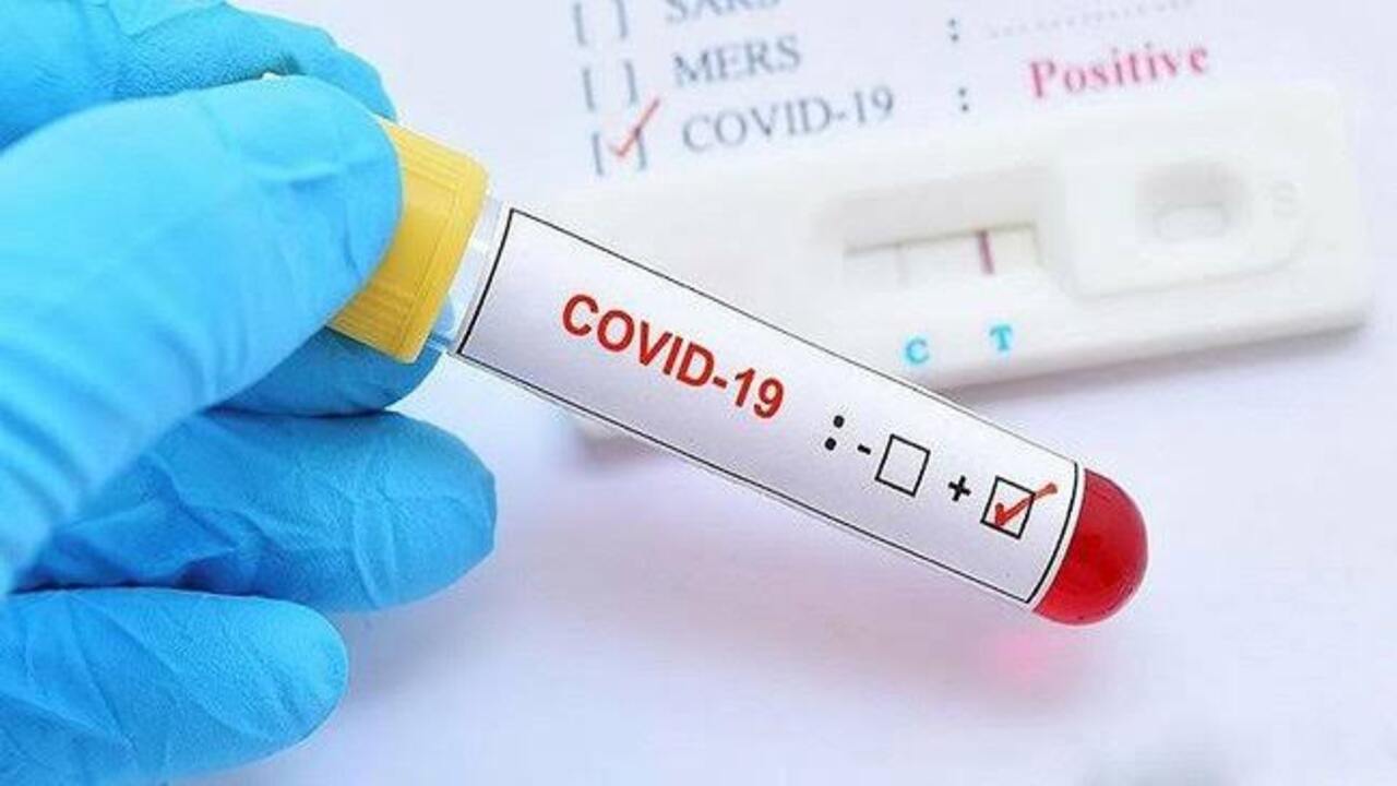 Uzmanlar Covid-19 Belirtilerine Dikkat Edilmesi Konusunda Uyardı