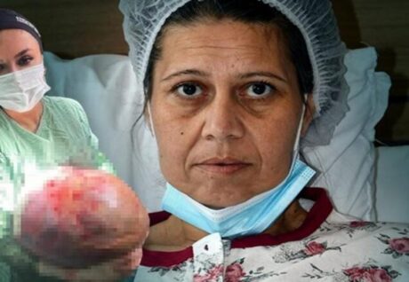Karın Şişliği İçin Hastaneye Giden Kadının Vücudundan 20 Kilo Kitle Çıktı
