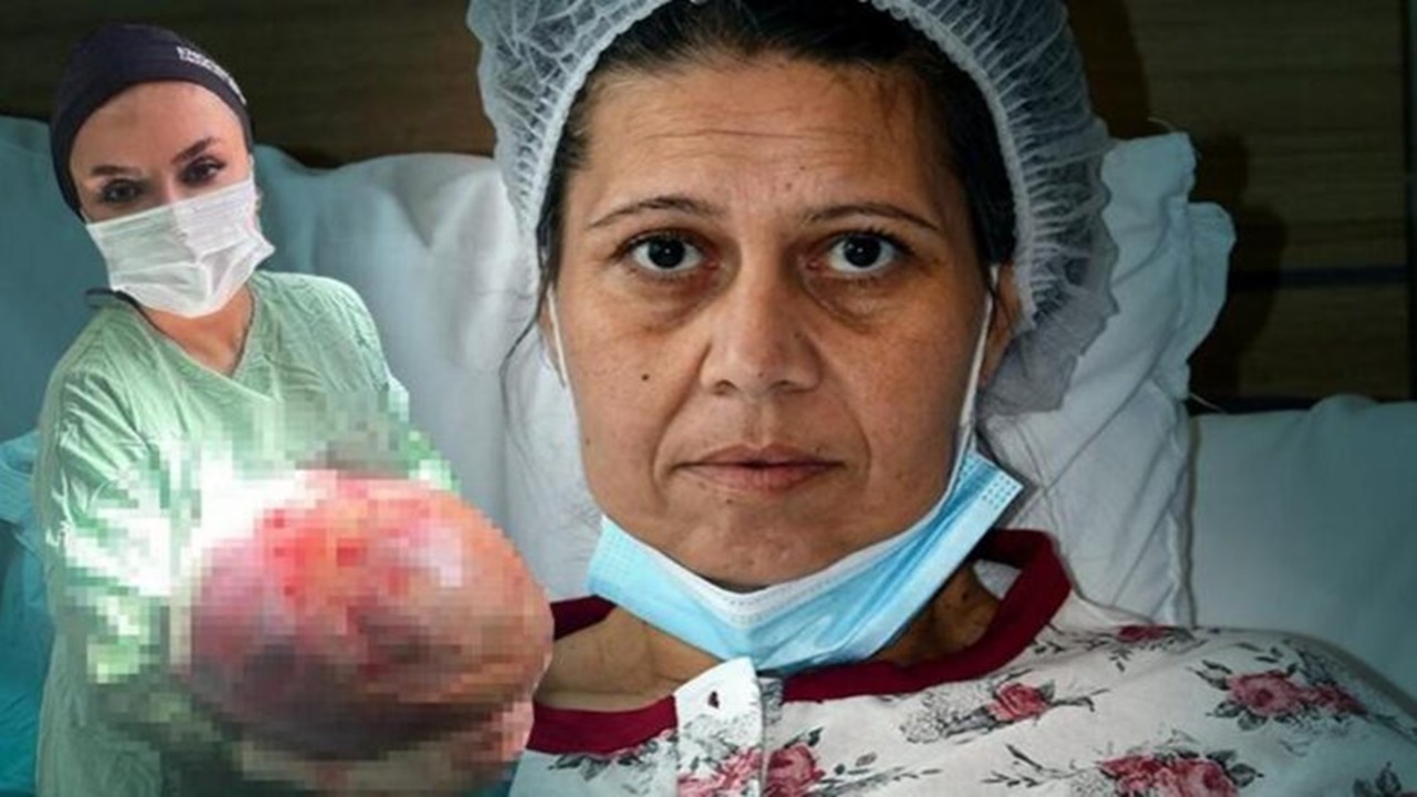 Karın Şişliği İçin Hastaneye Giden Kadının Vücudundan 20 Kilo Kitle Çıktı