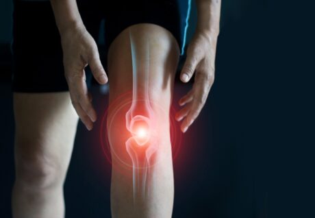 Osteoartrit Tedavisinde Yeni Umut: Kök Hücre Keşfi