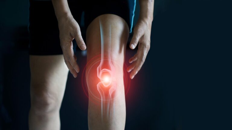 Osteoartrit Tedavisinde Yeni Umut: Kök Hücre Keşfi