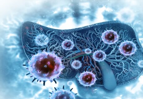 Yeni Kanser Tedavisi: Nanopartiküllerin Rolü