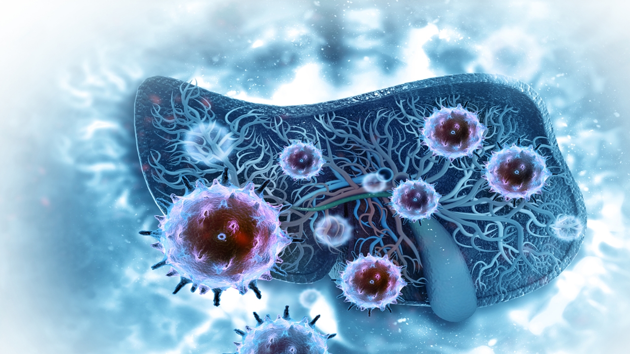 Yeni Kanser Tedavisi: Nanopartiküllerin Rolü